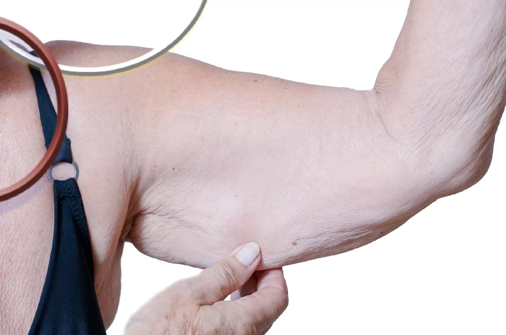 Desmistificando a Sarcopenia: O Que Você Precisa Saber Sobre a Perda de Massa Muscular na Idade Avançada